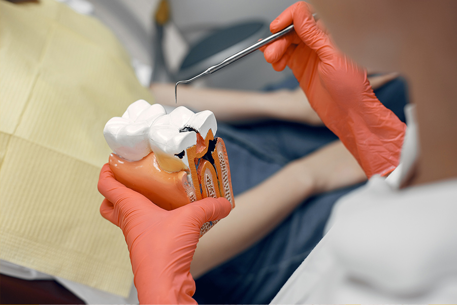 root canal treatment